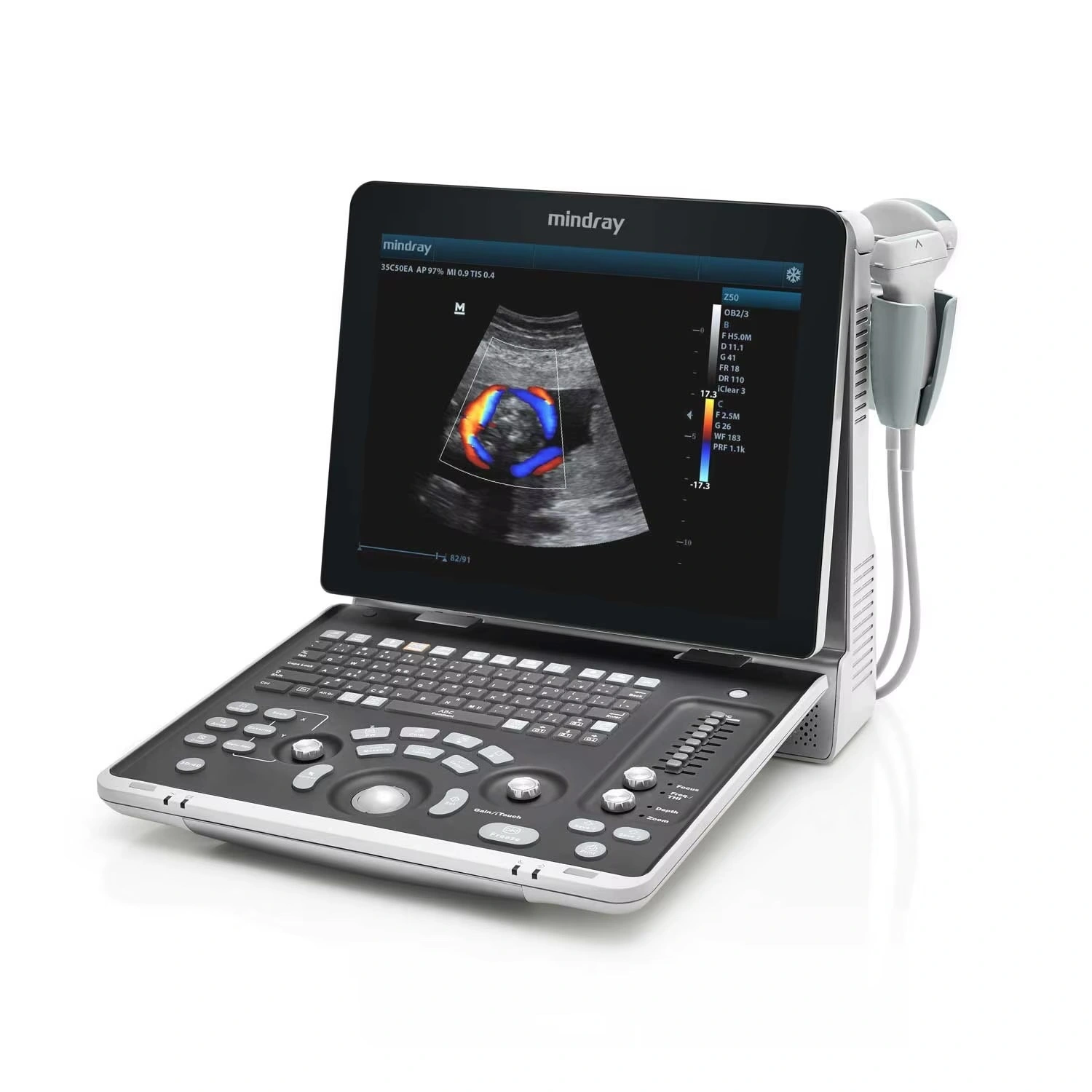 NEW Mindray Z60 Ultrasound Mindray z60 Ultrasound Mindray Z60 Ultrasound Mindray z60 Ultrasound