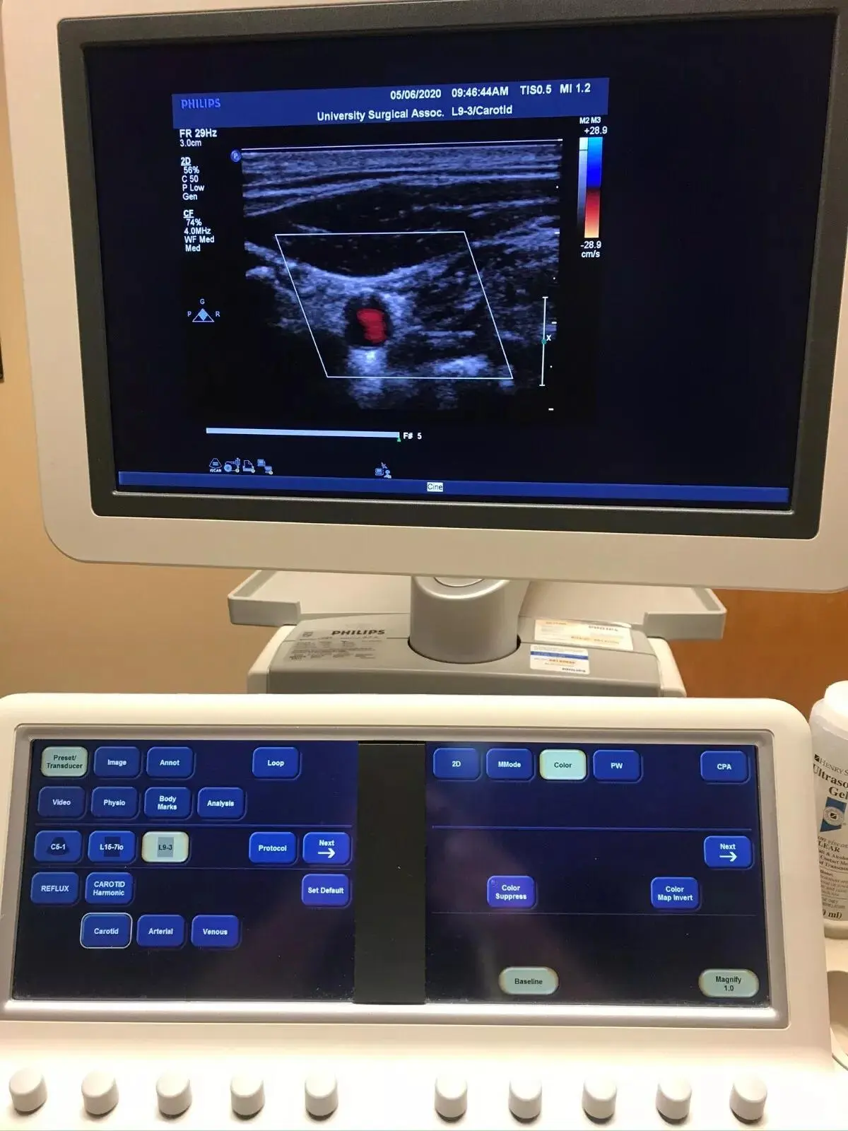Used Philips Philips iE33 Cardiovascular Ultrasound System — Refurbished Medical Imaging - Other Texas US | PT Medical Technologies #1458915