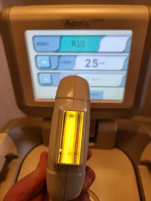 Used 2010 ALMA HARMONY XL Lasers / Laser Systems Minnesota US | Midwest Medical #1467829