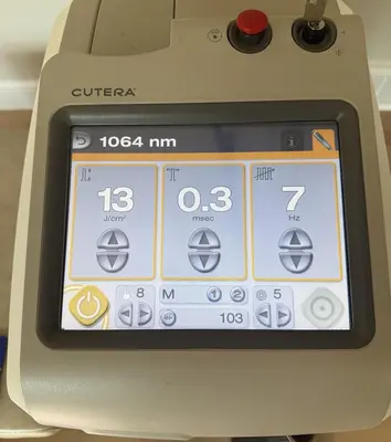 Used CUTERA EXCEL HR 1064/755 NM LASER HAIR REMOVAL, PIGMENTED & VASCULAR LESIONS , LASER GENESIS Lasers / Laser Systems Minnesota US | Midwest Medical #1467808