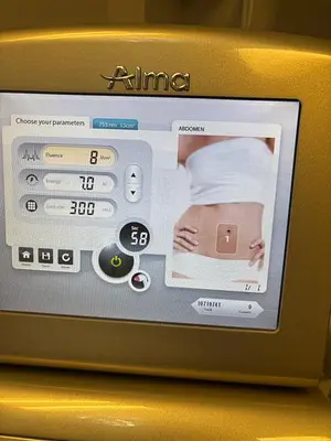 Used 2019 ALMA SOPRANA ICE Lasers / Laser Systems North Carolina US | Midwest Medical #1467811