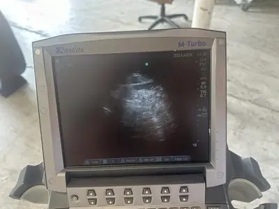 Used Sonosite Sonosite M-Turbo Medical Imaging - Other Texas US | PT Medical Technologies #1458933