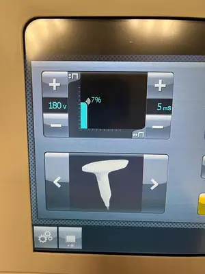 Used 2015 VENUS CONCEPTS VENUS VIVA RF FRACTIONAL SKIN RESURFACING & ELECTRO MAGNETIC FIELDS WRINKLE REDUCTION Medical Equipment - Other Minnesota US | Midwest Medical #1467840