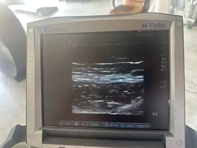 Used Sonosite Sonosite M-Turbo Ultrasound System w/ L25 & P21 ProbeS w/ Power Supply & CART Medical Imaging - Other Texas US | PT Medical Technologies #1458796