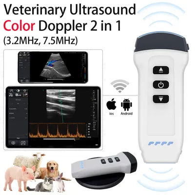 Used Philips Philips Diagnostic Ultrasound System w/ Probes Medical Imaging - Other Texas US | PT Medical Technologies #1458938