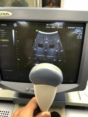 Used _UNKNOWN_ _UNKNOWN_ Medical Imaging - Other New York US | AME Ultra Sounds #1497662