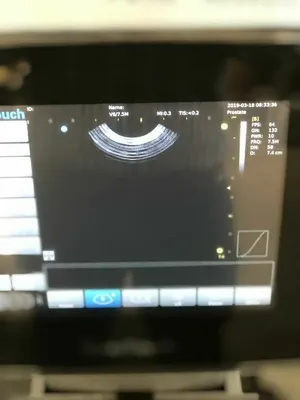 Used _UNKNOWN_ _UNKNOWN_ Medical Imaging - Other New York US | AME Ultra Sounds #1497661