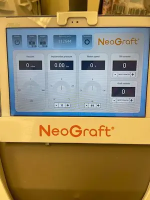 Used 2018 VENUS NEOGRAFT 2.0 Surgical Instruments - Other Minnesota US | Midwest Medical #1467846