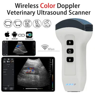 Used Philips Philips Diagnostic Ultrasound System w/ Probes Medical Imaging - Other Texas US | PT Medical Technologies #1458938