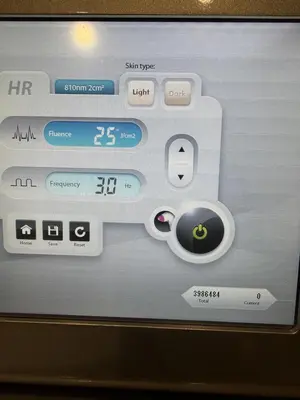 Used 2018 ALMA SOPRANO ICE HAIR REMOVAL LASER 810 DIODE Lasers / Laser Systems Texas US | Midwest Medical #1467822