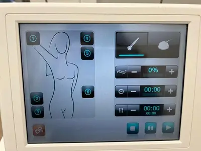 Used VENUS CONCEPTS VENUS CONCEPTS VENUS Medical Equipment - Other Minnesota US | Midwest Medical #1467847