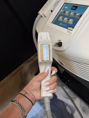 Used 2019 SCITON BBLS SKIN TYTE II, VASCULAR LESIONS, FOREVER CLEAR, FOREVER YOUNG Lasers / Laser Systems Texas US | Midwest Medical #1467827