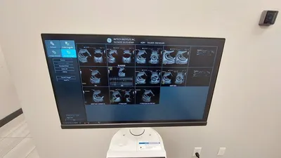 2022 GE LOGIC P9 MEDICAL EQUIPMENT | Platinum Group (11)