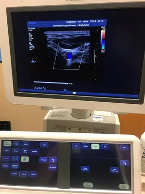 Used Philips Philips iE33 Cardiovascular Ultrasound System — Refurbished Medical Imaging - Other Texas US | PT Medical Technologies #1458915