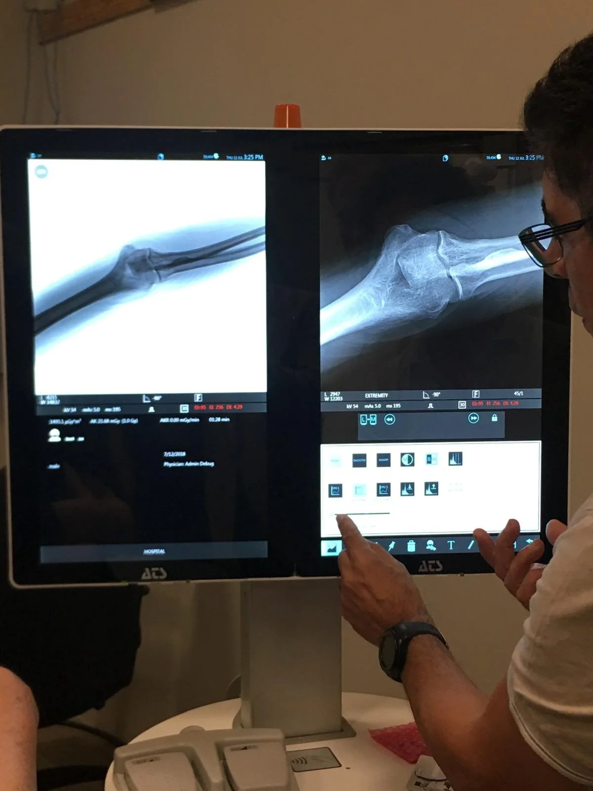 Used OrthoScan FD-Pulse X-Ray - Medical Texas US | PT Medical Technologies #1458604
