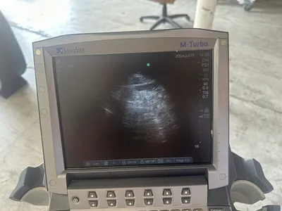 Used Sonosite Sonosite M-Turbo Ultrasound System w/ L25 & P21 ProbeS w/ Power Supply & CART Medical Imaging - Other Texas US | PT Medical Technologies #1458796