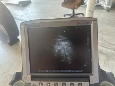 Used Sonosite Sonosite M-Turbo Ultrasound System w/ L25 & P21 ProbeS w/ Power Supply & CART Medical Imaging - Other Texas US | PT Medical Technologies #1458796