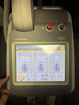Used 2021 CUTERA XEO W/ FULL ND YAG AND LIMELIGHT, LASER GENESIS Lasers / Laser Systems Minnesota US | Midwest Medical #1467823