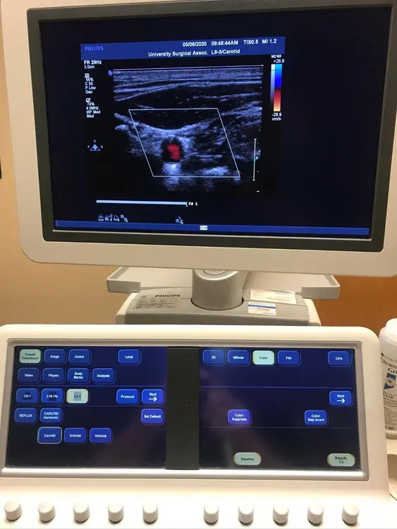 Used Philips Philips iE33 "R" Revision Ultrasound on Cart — Refurbished Medical Imaging - Other Texas US | PT Medical Technologies #1458985