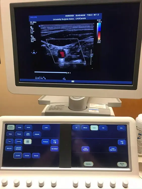 Used Philips Philips iE33 Cardiovascular Ultrasound System — Refurbished Medical Imaging - Other Texas US | PT Medical Technologies #1458915