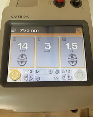 Used CUTERA EXCEL HR 1064/755 NM LASER HAIR REMOVAL, PIGMENTED & VASCULAR LESIONS , LASER GENESIS Lasers / Laser Systems Minnesota US | Midwest Medical #1467808