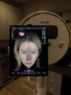 Used 2023 ALMA IQ ADVANCED COMPUTERIZED SKIN-IMAGING Medical Imaging - Other Texas US | Midwest Medical #1494066
