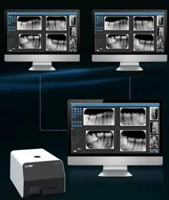 New | in-Stock VRN EQ-600 Digital Dental X Ray Imaging Plate Film VRN EQ-600 Digital Dental X Ray Imaging Plate Film Dental Instruments Kentucky US | Meghandepllc #1275456