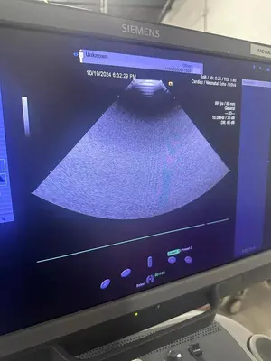 Used Acuson ACUSON Acuson S2000 Medical Imaging - Other Texas US | PT Medical Technologies #1458899