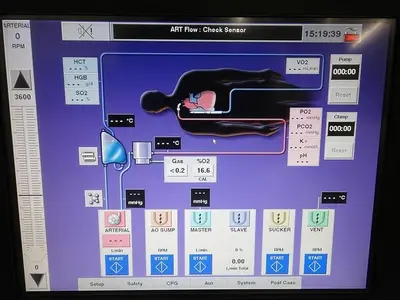 Used TERUMO CARDIOVASCULAR ADVANCED PERFUSION SYSTEM 1 Medical Equipment - Other North Carolina US | Denova Medical #1523954