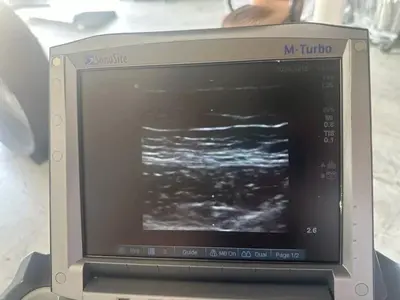 Used Sonosite Sonosite M-Turbo Medical Imaging - Other Texas US | PT Medical Technologies #1458933
