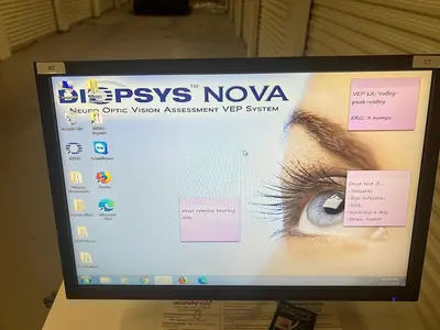 Used DIOPSYS NOVA VEP Ophthalmology Minnesota US | Midwest Medical #1467818