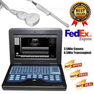 Used Sonix Ultrasonix Analogic Medical Imaging - Other Texas US | PT Medical Technologies #1458920
