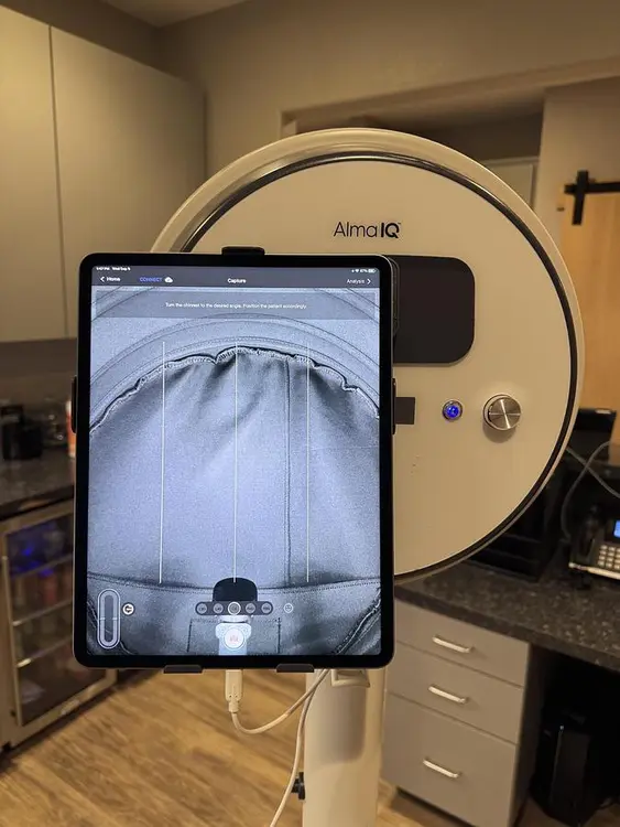 Used 2023 ALMA IQ ADVANCED COMPUTERIZED SKIN-IMAGING Medical Imaging - Other Texas US | Midwest Medical #1494066
