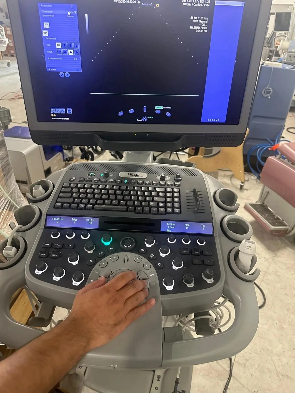 Used Acuson 2019 Siemens Acuson S2000 with 8V3 , 4V1c, 10V4 Probes Medical Imaging - Other Texas US | PT Medical Technologies #1458914