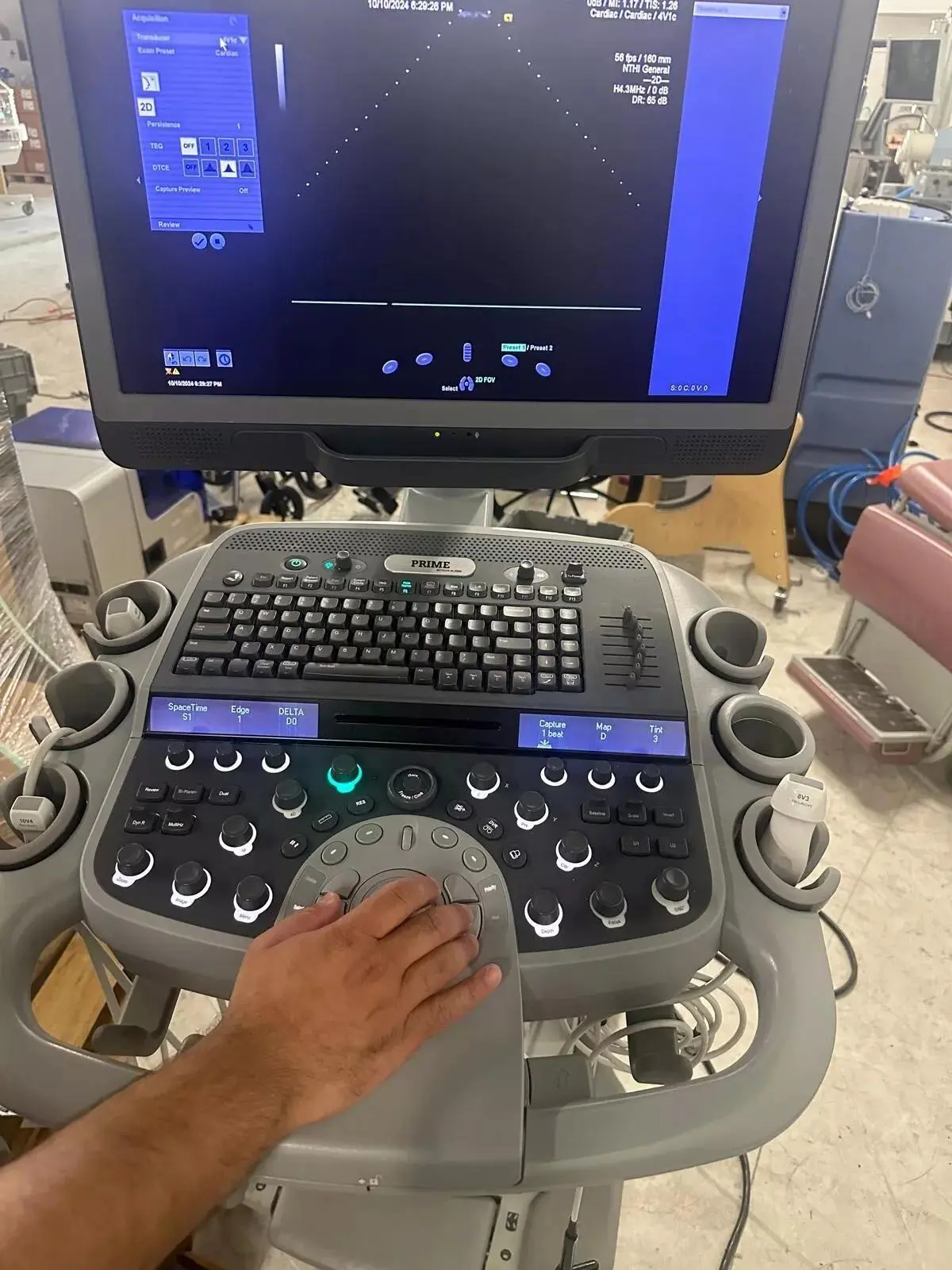 Used Acuson ACUSON Acuson S2000 Medical Imaging - Other Texas US | PT Medical Technologies #1458899