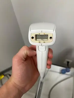 Used 2015 VENUS CONCEPTS VENUS VIVA RF FRACTIONAL SKIN RESURFACING & ELECTRO MAGNETIC FIELDS WRINKLE REDUCTION Medical Equipment - Other Minnesota US | Midwest Medical #1467840