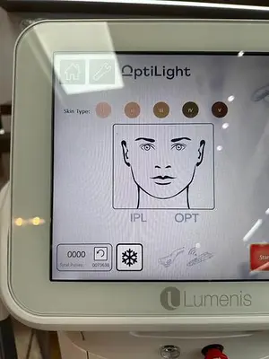 Used 2022 LUMENIS OPTILIGHT Ophthalmology Texas US | Midwest Medical #1467845